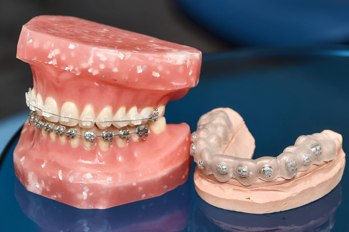 The Value of Community-Oriented Orthodontic Care in Silver Lake